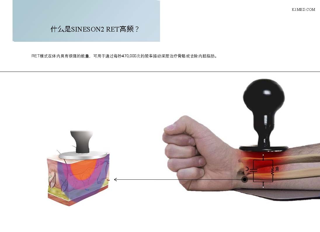 5a4d1758700313.jpg